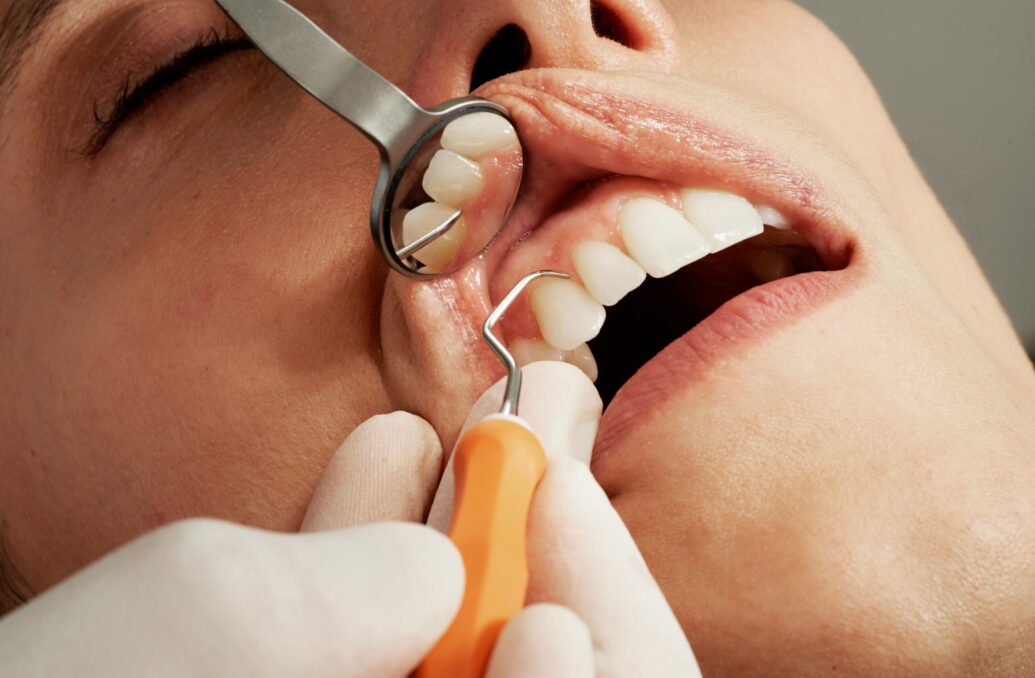 Basic Periodontal Examination