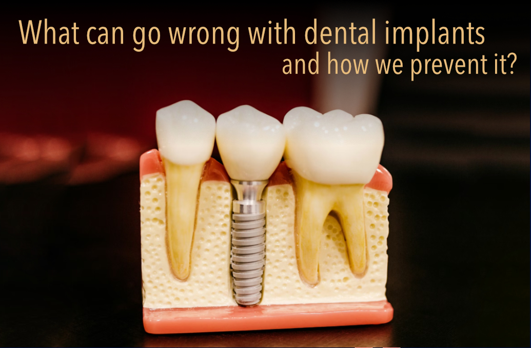 What can go wrong with dental implants?