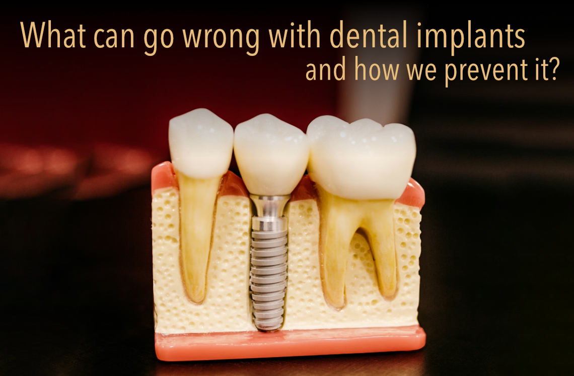 What can go wrong with dental implants?
